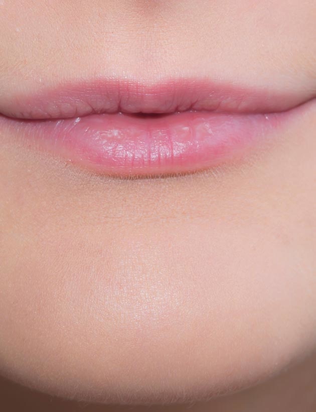 thin lips fillers London sas aesthetics