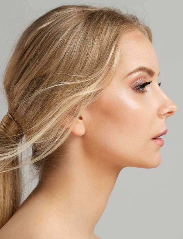 Nose Thread Lifts Kensington side profile sas aesthetics